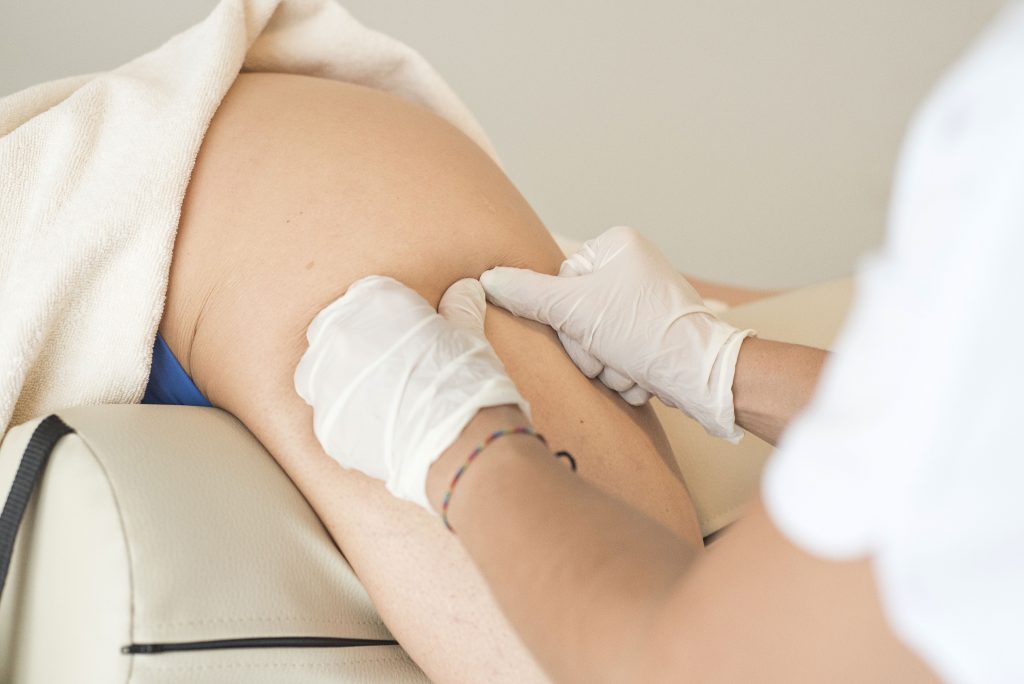 Bursitis